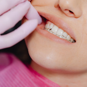 Best Practices to Stop Teeth Grinding