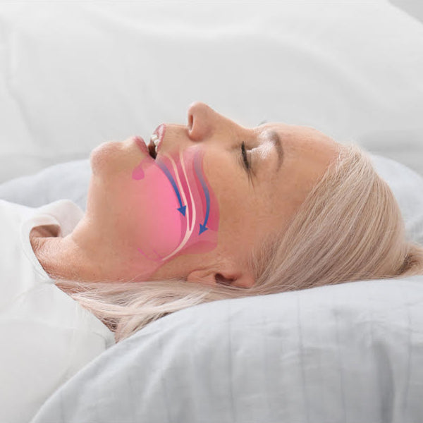 What is Sleep Apnea and How to Treat It?