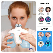 Sonmol Electric Nasal Rinsing System