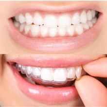 Bruxism thin mouth guard nz for treatment of bruxism symptoms and for pain relief from bruxism, tmj and teeth grinding problems. Before and after of Snorblok Slim non choking anti bruxism appliance to help bruxism causes.
