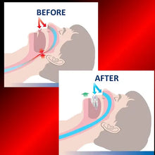 BPA free anti snore mouthpiece for adults designed to stop snoring and support better breathing 